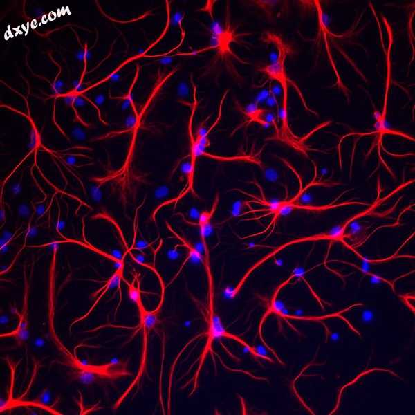 Astrocytes are depicted in red. Cell nuclei are depicted in blue. Astrocytes wer.jpg