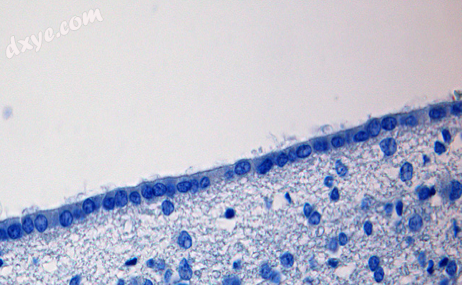 Photomicrograph of normal 室管膜l cells at 400× magnification in human autops.png