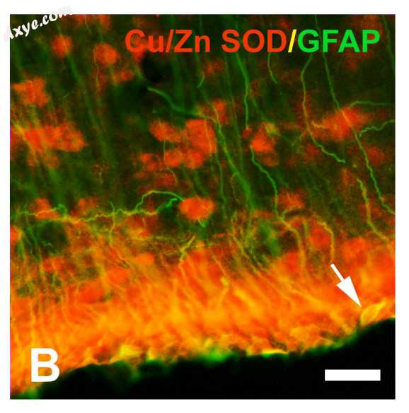 第三脑室 wall in the brain of an immature rat. A 伸长细胞 coexpressing Cu.jpg