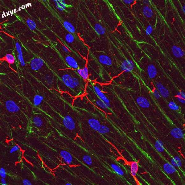 Microglia in rat cerebellar molecular layer in red, stained with antibody to IB.jpg