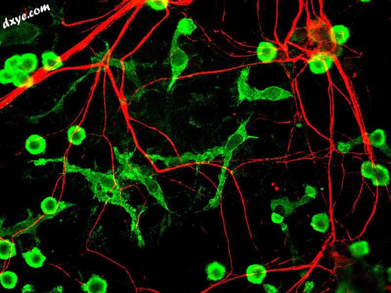 Rat microglia grown in tissue culture in green, along with nerve fiber processes.jpg