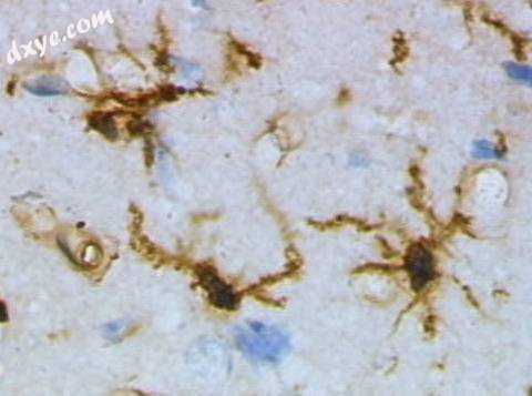 Microglia in resting state from rat cortex before 创伤tic brain injury (lectin.jpg