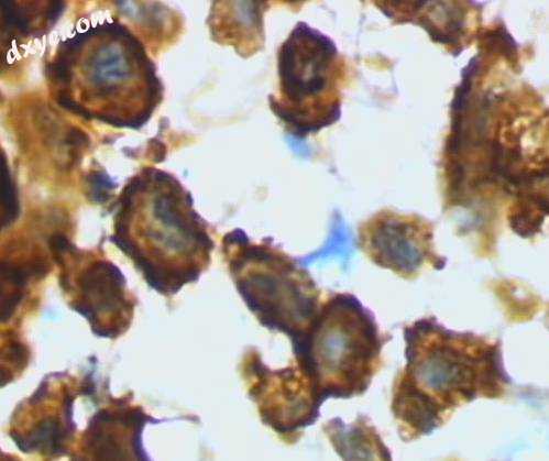 Microglia macrophage – activated form from rat cort.jpg