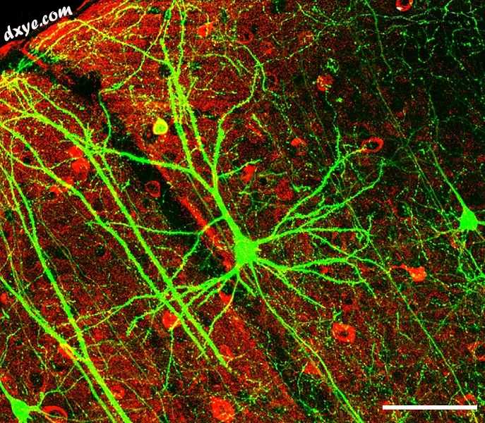 A network of dendrites from neurons in the 海马..jpg