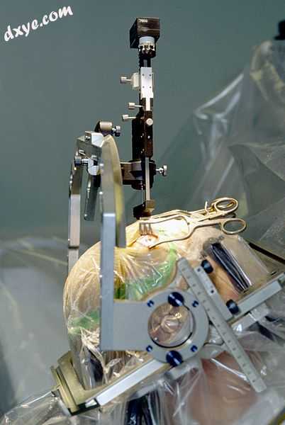 Stereotactic guided insertion of DBS electrodes in neurosurgery.jpg