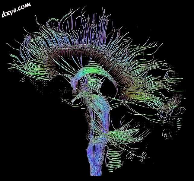 An image of neural pathways in the brain taken using diffusion tensor imaging.jpg