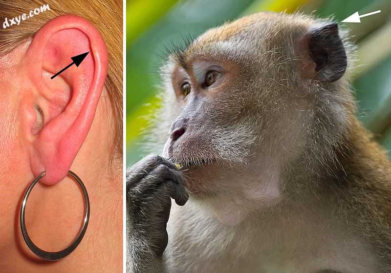 Left Darwin&#039;s tubercle. Right  the homologous point in a macaque..jpg