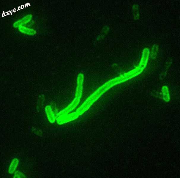 Yersinia pestis seen at 200× magnification with a fluorescent label..jpeg