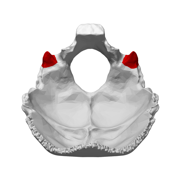 Occipital bone. Inner surface. 颈静脉突 shown in red..png