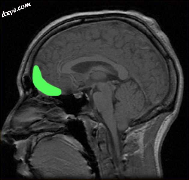 Location of the orbito-frontal cortex shown through MRI.jpg