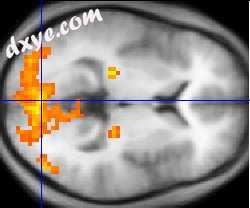 An example of an fMRI brain scan. fMRI outputs (yellow) are overlaid on the aver.jpg