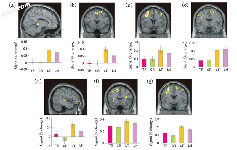 The diagram above is an overview of the varying patterns of brai.png