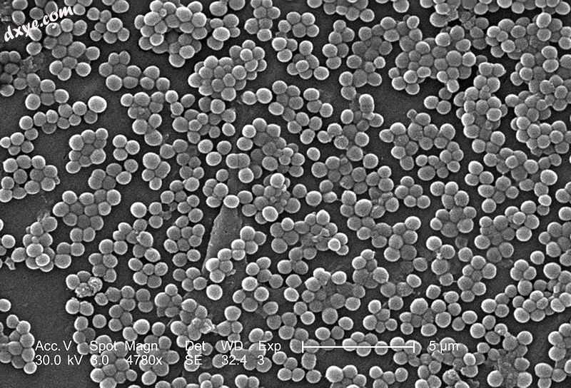 MRSA, a rare pathogen associated with some cases of 脊椎骨髓炎.jpg