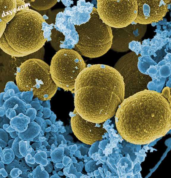 Staphylococcus aureus, the most common microorganism associated with vertebral o.jpg