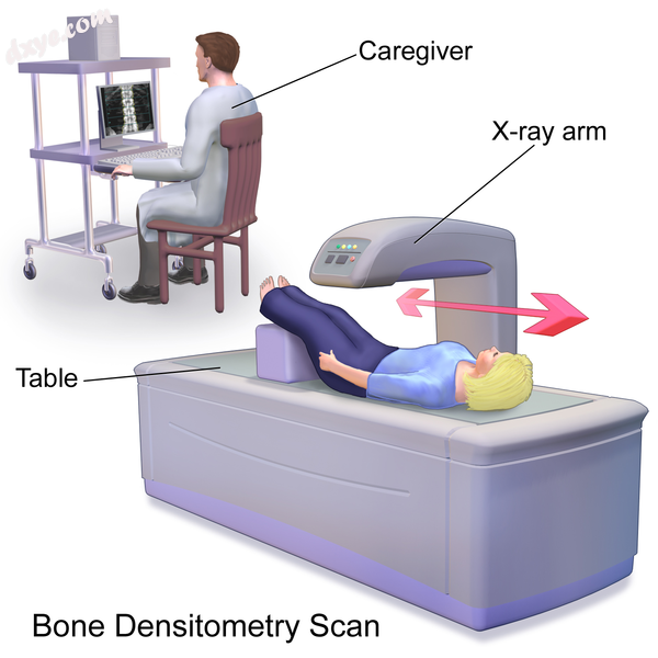 Illustration of Bone Densitometry Scan.png