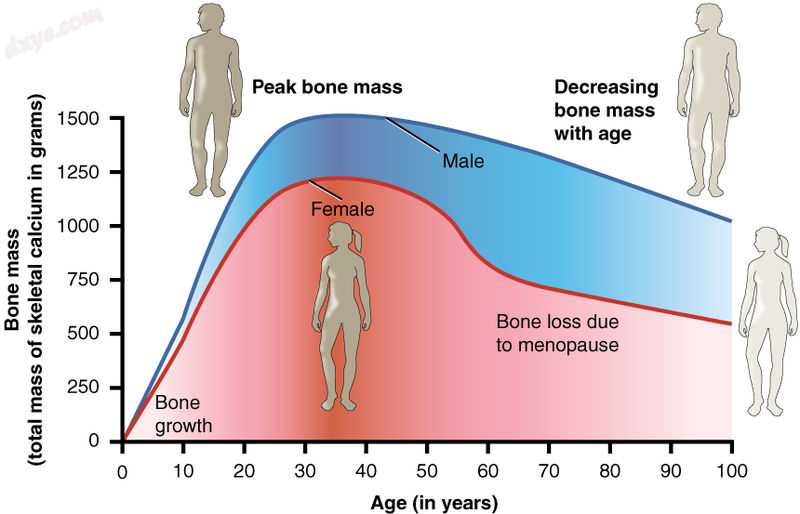 Bone density peaks at about 30 years of age. Women lose bone mass more rapidly t.jpg