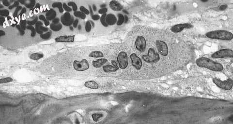 Light micrograph of an osteoclast displaying typical distinguishin.jpg