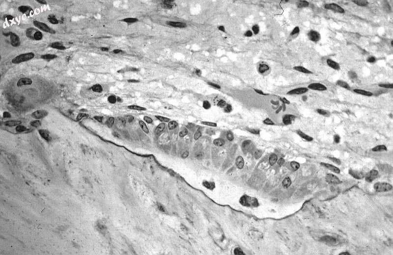 Light micrograph of osteoblasts, several displaying a prominent Golgi apparatus,.jpg