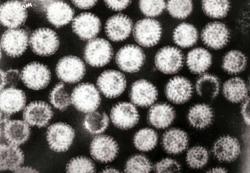 An electron micrograph of rotavirus, the cause of nearly 40% of hospitalizations.jpg