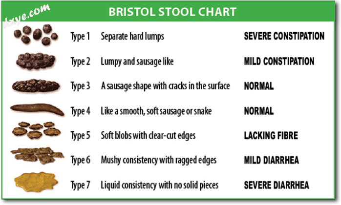Bristol stool chart.png