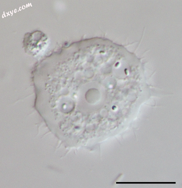 Acanthamoeba trophozoite. Scale bar 10 μm.png