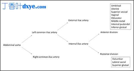 髂内动脉的解剖结构及其对围产期和盆腔出血的教育性解剖