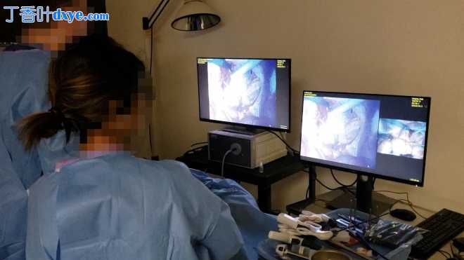 双视角多分辨率腹腔镜，实现更安全、更高效的微创手术