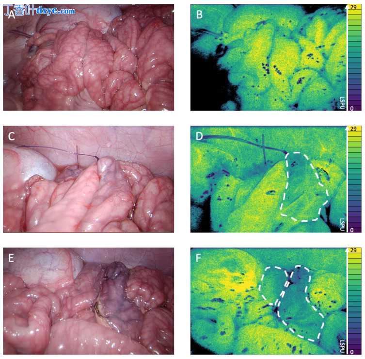 腹腔镜激光散斑对比成像可以可视化吻合灌注：在猪模型中的演示