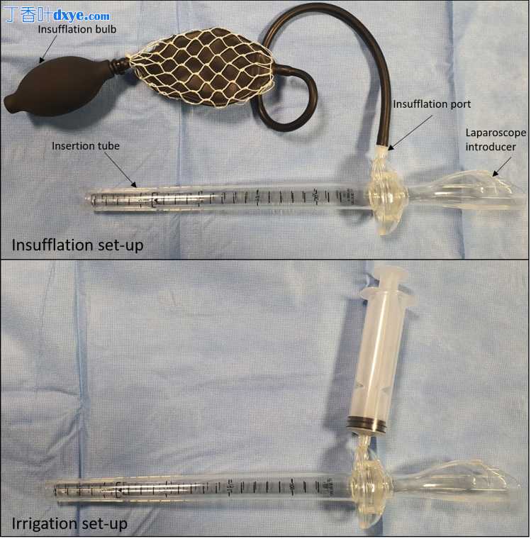 左侧结直肠切除术后用荧光血管造影评估腔内吻合完整性的新方法