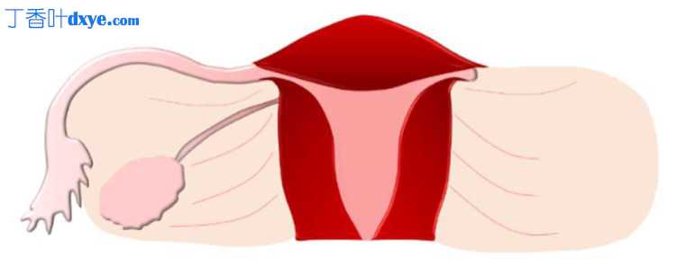 输卵管解剖变异和先天性异常及其对生育能力的影响概述