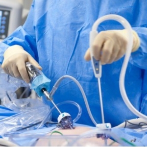 腹腔镜手术是什么？