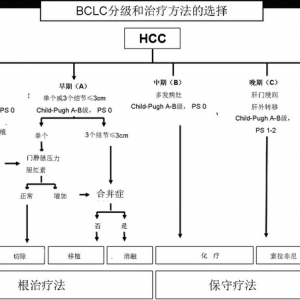 临床综述：肝细胞癌前沿进展