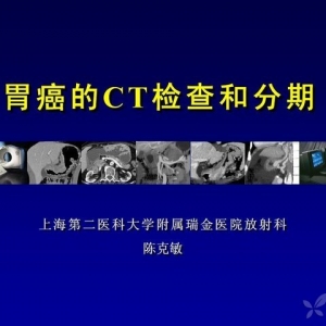 陈克敏：胃癌的CT检查和分期