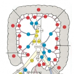 II/III期结肠癌D3腹腔镜切除短期结局优于开腹手术