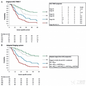 囊外淋巴结转移状态可提高食管和GOJ腺癌pN1分期准确性
