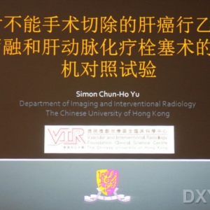 余俊豪教授：经肝动脉酒精消融与TACE的随机对照研究