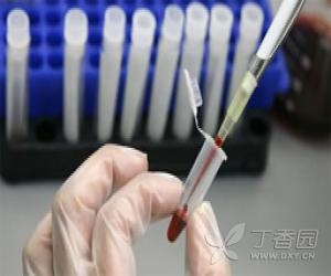Nat Med：溶瘤免疫治疗或是对抗肝癌新利器