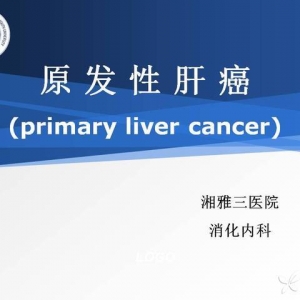 原发性肝癌的诊治