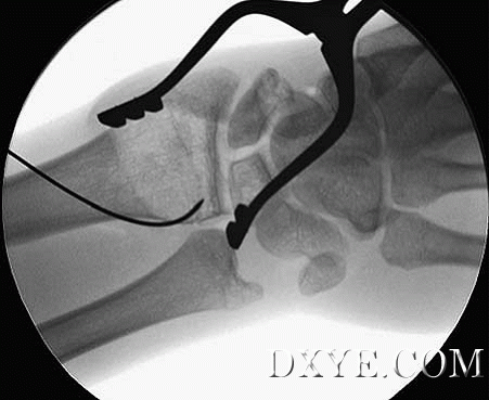 image007.gif