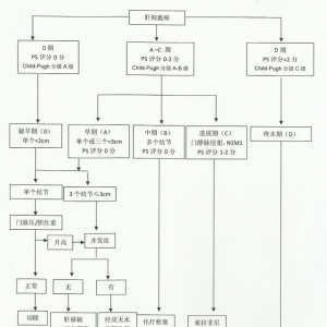 肝癌及其他疾病中的动脉化疗栓塞和Y-90治疗