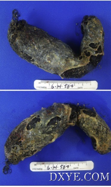AB214DCA-761E-45F0-8AFF-5BD54754990A.png