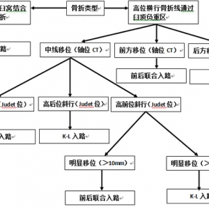 治疗髋臼后壁横行骨折的手术入路策略