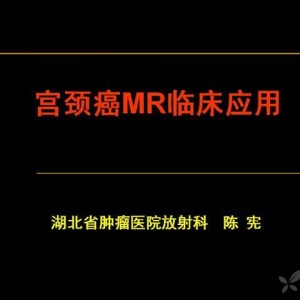 陈宪：宫颈癌MRI临床应用