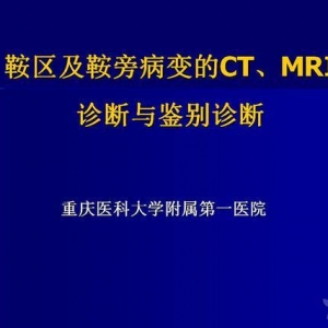 鞍区及鞍旁病变的CT、MRI诊断与鉴别诊断
