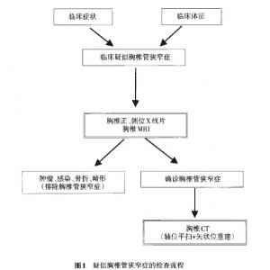 胸椎管狭窄症诊疗指南