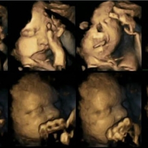 孕妇吸烟 胎儿做鬼脸抗议「好臭」 (附图)