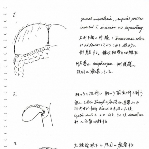 精品病例讲座之三：肝癌(二)(多图)