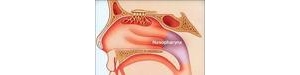 鼻咽癌外科手术治疗有哪些新技术？