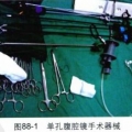 经脐单孔腹腔镜手术