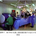 da Vinci 机器人辅助腹腔镜手术